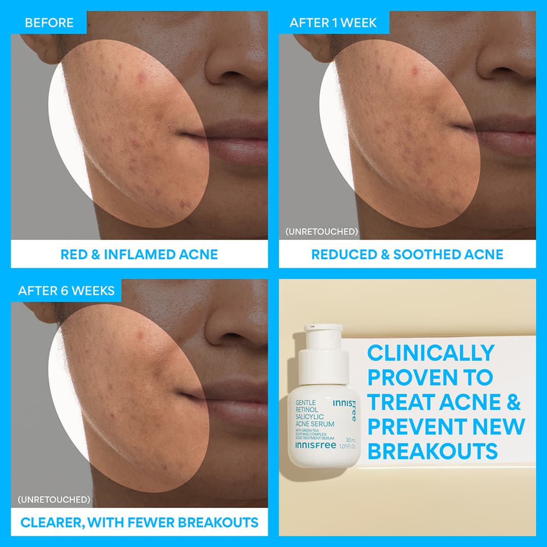 The Smooth Skin Kit - Image 10