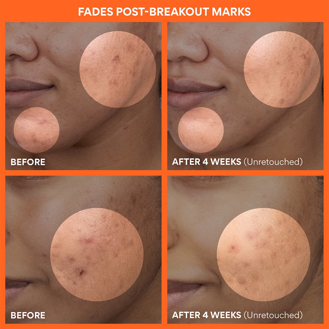 Green Tea Enzyme Vitamin C Brightening Toner Pads - Image 5