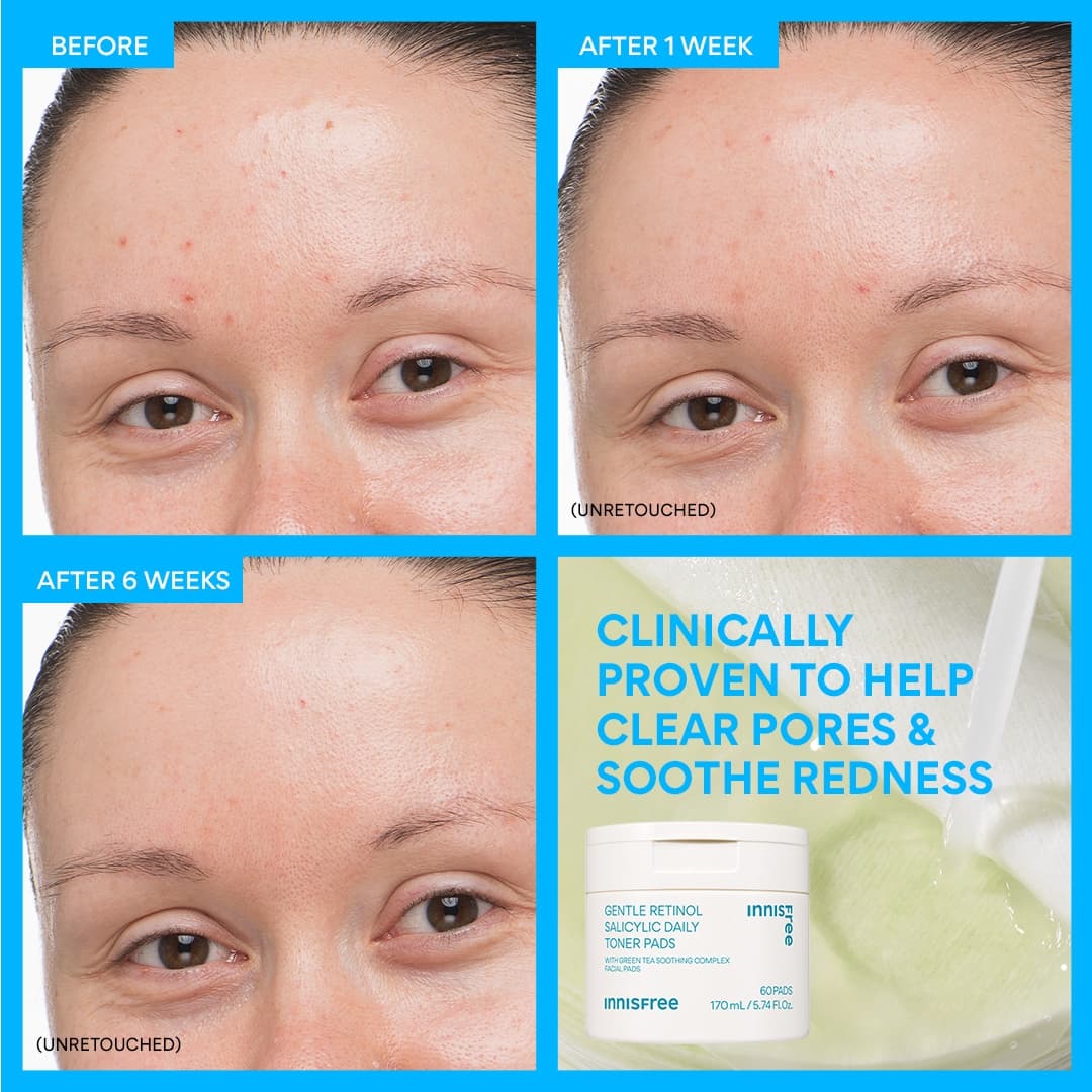 The Smooth Skin Kit - Image 7